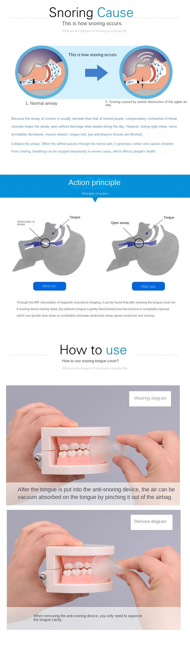 1pc Anti Snoring Mouthpiece Device Tongue Stopper Medical Silicone Sleep Guard Stopper Tongue Retain Breathing Aid Snore Apnea